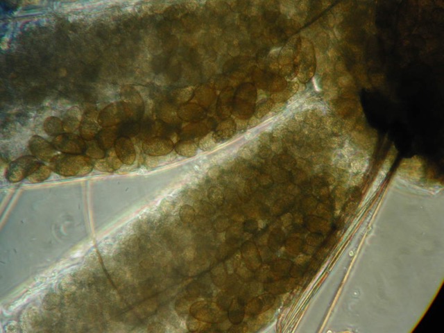 <i>Coelomomyces stegiomyiae</i> parasitizing a mosquito larva
