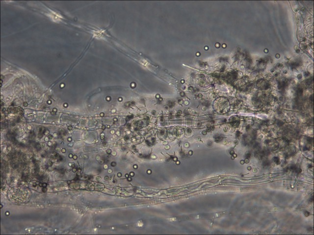 <i>Caulochytrium protostelioides</i> aerial sporangia