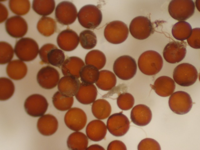 Spores of <i>Scutellospora heterogama</i>