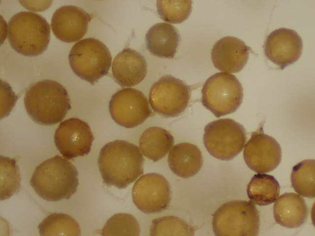 Spores of <i>Glomus mosseae</i>