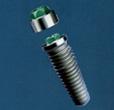 Steri-Oss® Replace Implant